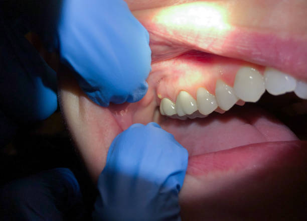 Best Emergency Treatment for Toothache in Canby, OR